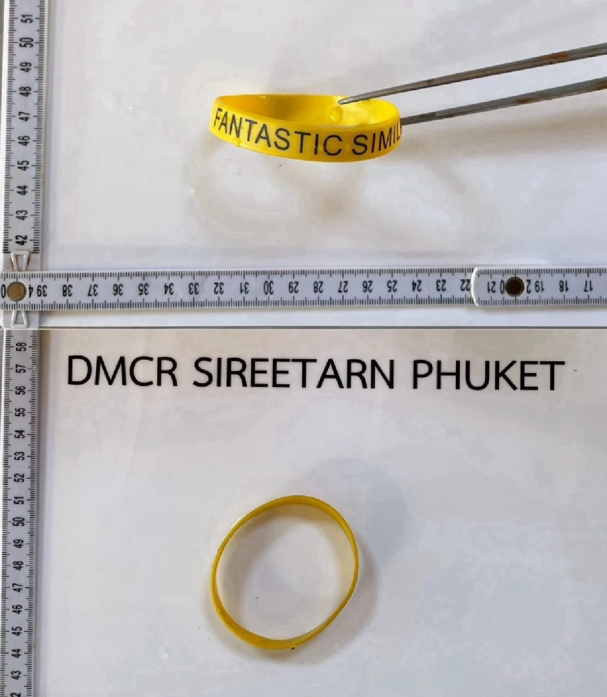 27 วันในท้องเต่าสิมิลัน กับ 'สายรัดข้อมือ' อาหารที่ถูกมนุษย์หยิบยื่นให้