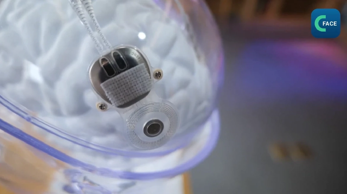 PHOTO : China Media Group