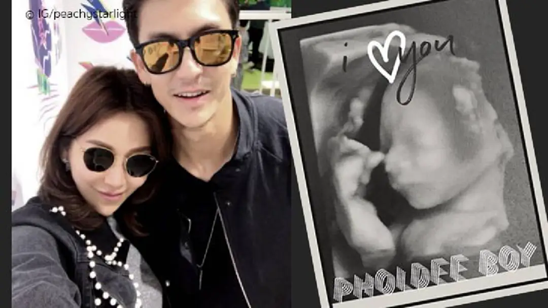 ลูกคนที่ 2 “ติ๊ก เจษฎาภรณ์” ฉายแววหล่อตั้งแต่อยู่ในท้อง ลูกคนที่ 2 “ติ๊ก เจษฎาภรณ์” ฉายแววหล่อตั้งแต่อยู่ในท้อง