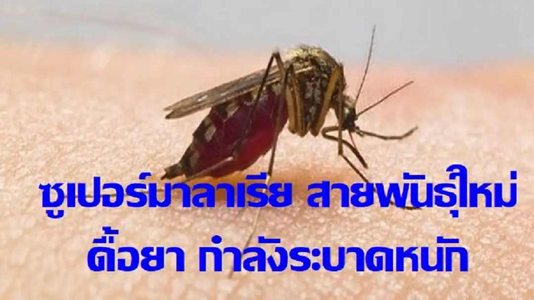 ‘ซูเปอร์มาลาเรีย’ ระบาดหนักลุ่มแม่น้ำโขง ดื้อยารุนแรง ไม่ตอบสนองต่อการรักษา ‘ซูเปอร์มาลาเรีย’ ระบาดหนักลุ่มแม่น้ำโขง ดื้อยารุนแรง ไม่ตอบสนองต่อการรักษา