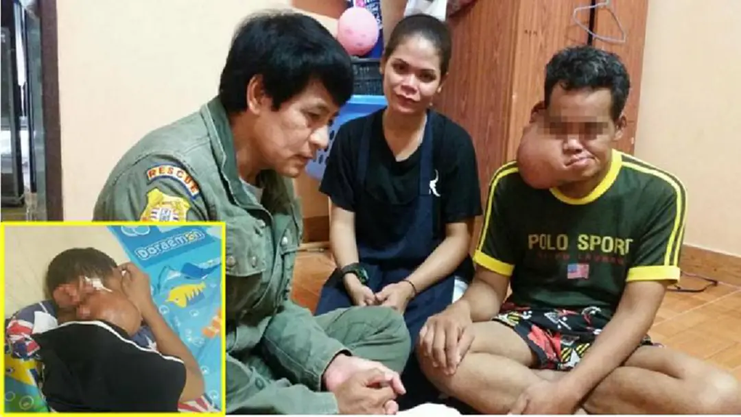 สุดน่าสงสาร!! ชายวัย 37ปี ป่วยมะเร็งต่อมน้ำลายระยะสุดท้าย ไปหาหมอเกือบทุกอาทิตย์ จนไม่เหลือเงินรักษา ขอวอนผู้ใจบุญร่วมช่วยเหลือ สุดน่าสงสาร!! ชายวัย 37ปี ป่วยมะเร็งต่อมน้ำลายระยะสุดท้าย ไปหาหมอเกือบทุกอาทิตย์ จนไม่เหลือเงินรักษา ขอวอนผู้ใจบุญร่วมช่วยเหลือ