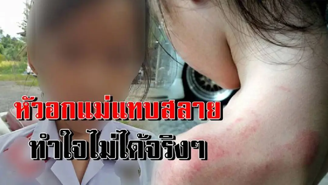 พ่อแม่คนไหนก็รับไม่ได้!!ลูกวัย7ขวบกลับจากโรงเรียน แทบน้ำตาไหลเห็นหัวไหล่มีรอยช้ำเป็นแผล เค้นถามถึงจุกอก..พอรู้ใครทำต้องฟ้องผอ.โรงเรียนด่วนๆ! พ่อแม่คนไหนก็รับไม่ได้!!ลูกวัย7ขวบกลับจากโรงเรียน แทบน้ำตาไหลเห็นหัวไหล่มีรอยช้ำเป็นแผล เค้นถามถึงจุกอก..พอรู้ใครทำต้องฟ้องผอ.โรงเรียนด่วนๆ!
