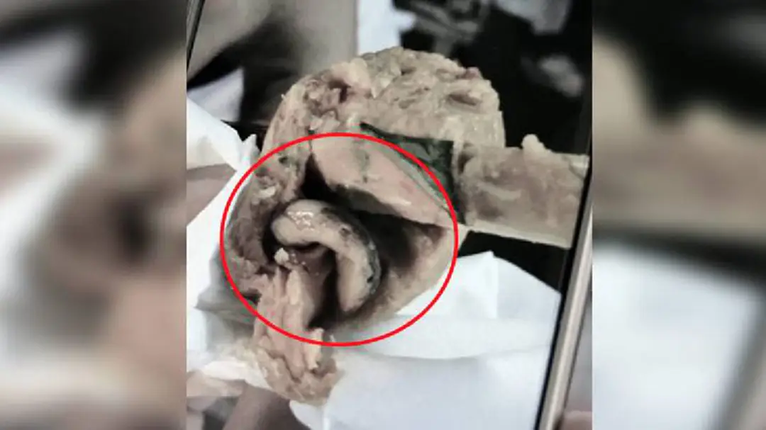 พ่อค้าของขึ้น! เหตุพบจิ้งจกในแจงลอน ปรี่แจ้งความหวังมือโพสต์ออกมาชี้แจง พ่อค้าของขึ้น! เหตุพบจิ้งจกในแจงลอน ปรี่แจ้งความหวังมือโพสต์ออกมาชี้แจง