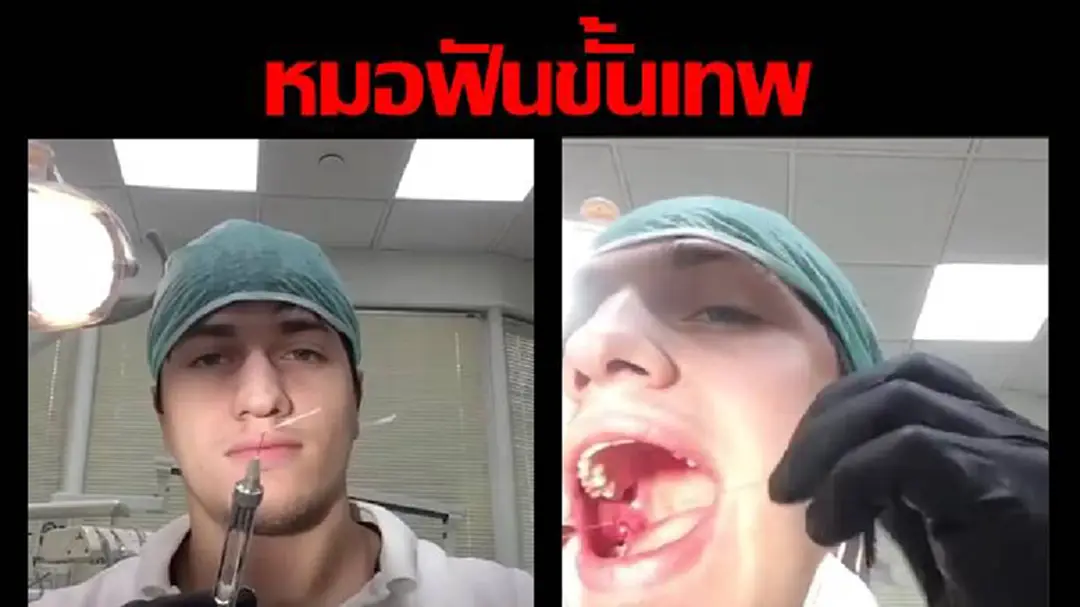 หมอฟันโชว์ถอนฟันคุดด้วยตัวเอง ทั้งถอนทั้งเย็บแผล แถมถ่ายคลิปมาโชว์ (คลิป) หมอฟันโชว์ถอนฟันคุดด้วยตัวเอง ทั้งถอนทั้งเย็บแผล แถมถ่ายคลิปมาโชว์ (คลิป)