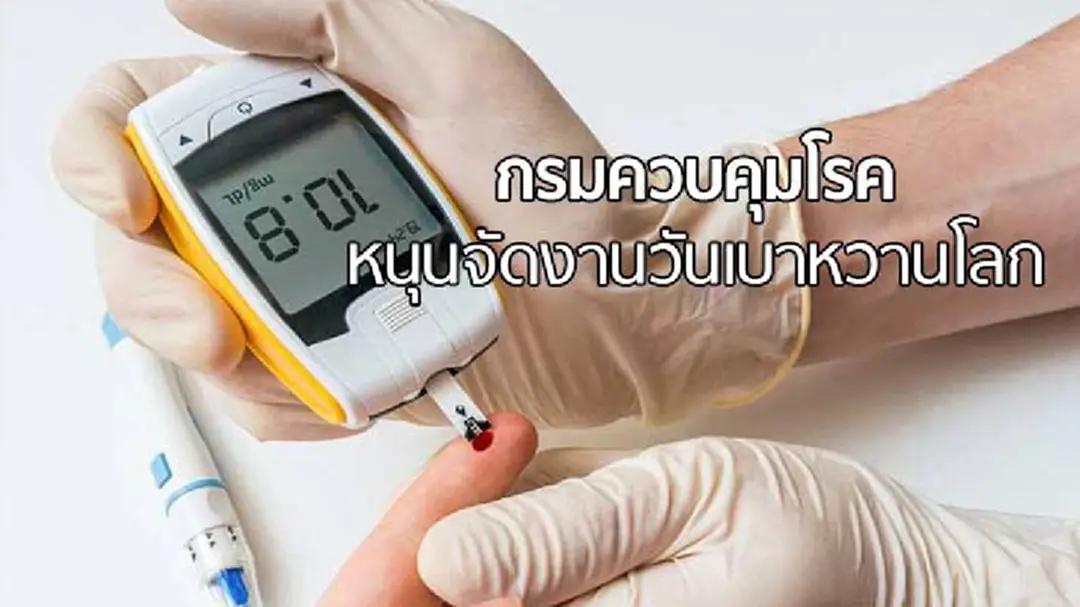 กรมควบคุมโรคจับมือพันธมิตรหนุนจัดงานวันเบาหวานโลกปี 60 กรมควบคุมโรคจับมือพันธมิตรหนุนจัดงานวันเบาหวานโลกปี 60