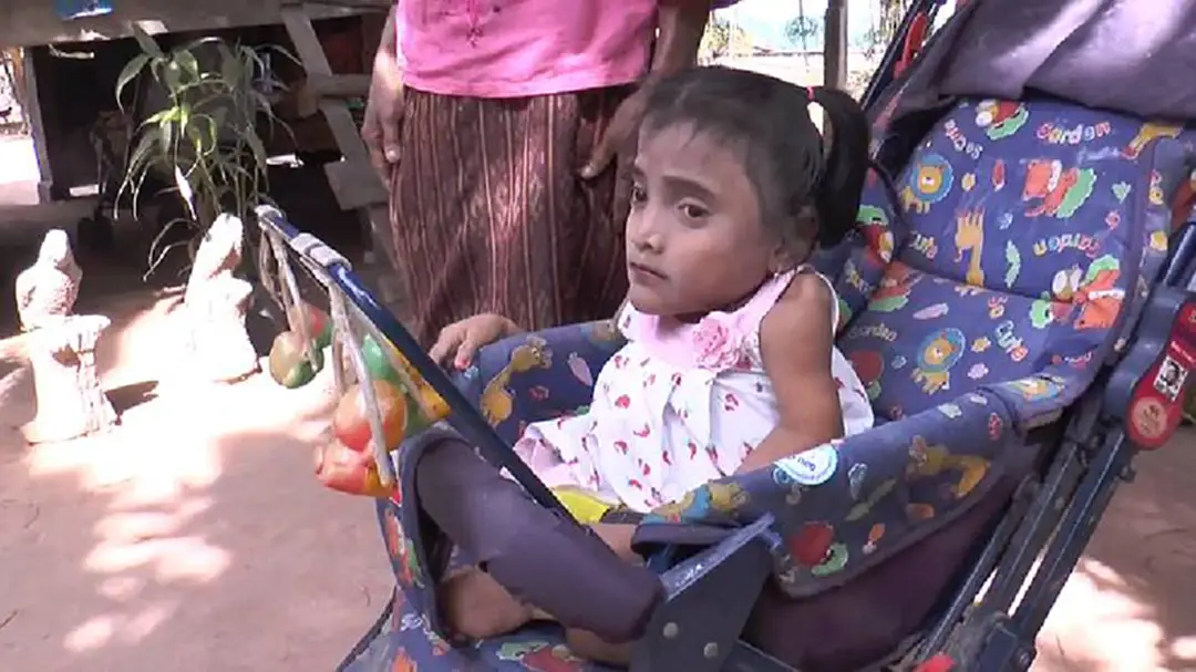 ด.ญ.วัย13ป่วยกระดูกพรุนตัวหดเท่าเด็ก 2 ขวบ วอนคนใจบุญช่วย