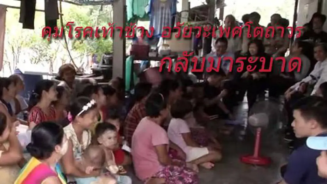 เฝ้าระวังเจาะเลือดแรงงานต่างด้าว รับเชื้อเท้าช้าง อาการหลบใน 3 – 5 ปี เฝ้าระวังเจาะเลือดแรงงานต่างด้าว รับเชื้อเท้าช้าง อาการหลบใน 3 – 5 ปี
