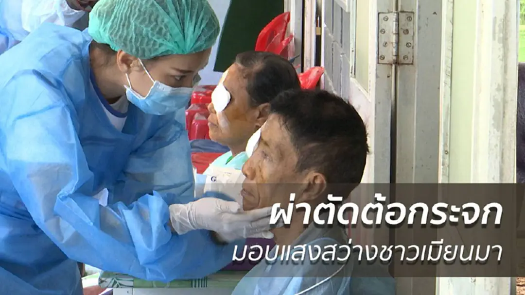 ผ่าตัดต้อกระจก มอบแสงสว่างชาวเมียนมา ผ่าตัดต้อกระจก มอบแสงสว่างชาวเมียนมา