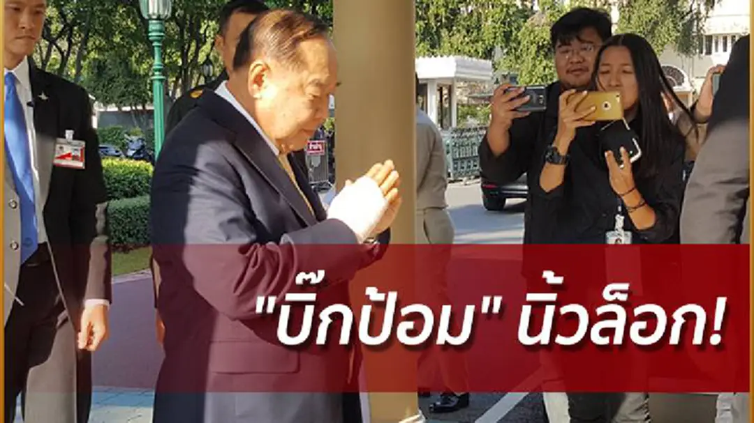 "บิ๊กป้อม" นิ้วล็อก! พันผ้าพันแผลที่ข้อมือขวา ขรึมปัดตอบคำถาม "บิ๊กป้อม" นิ้วล็อก! พันผ้าพันแผลที่ข้อมือขวา ขรึมปัดตอบคำถาม