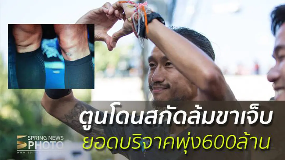 ตูนโดนสกัดล้มขาเจ็บ ยอดบริจาคพุ่ง600ล้านบาทแล้ว ตูนโดนสกัดล้มขาเจ็บ ยอดบริจาคพุ่ง600ล้านบาทแล้ว
