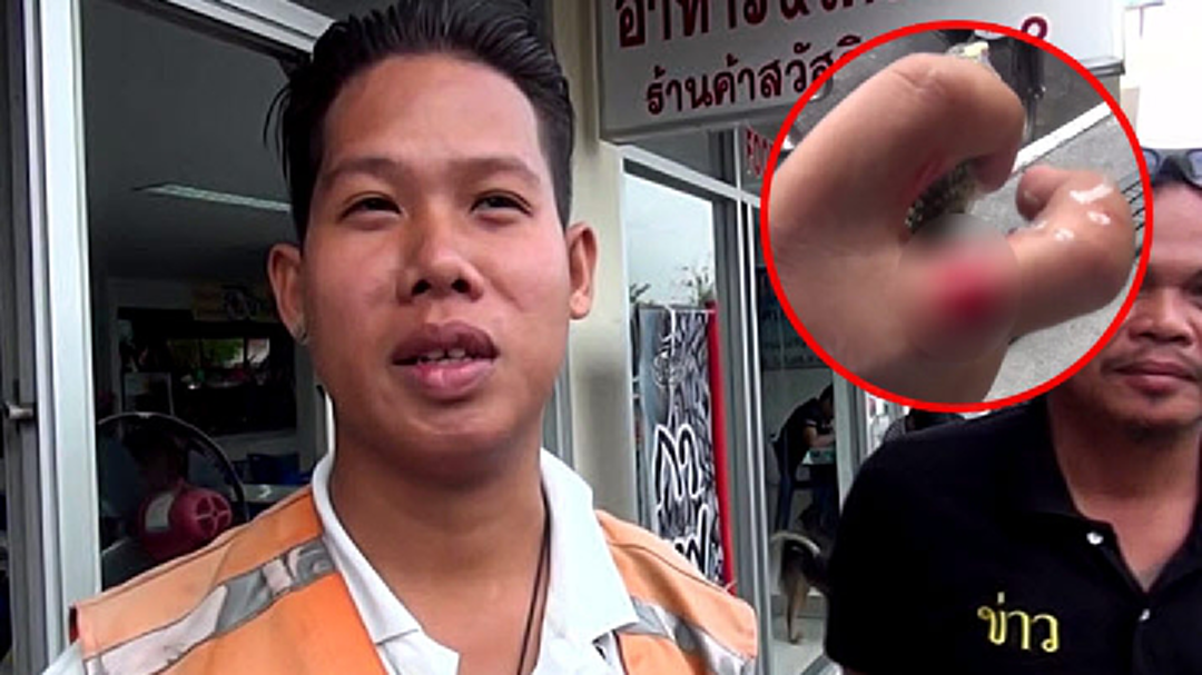 หวิดดับ! "หมองู" เมืองชลฯ พลาดถูกฉกเลือดสาด