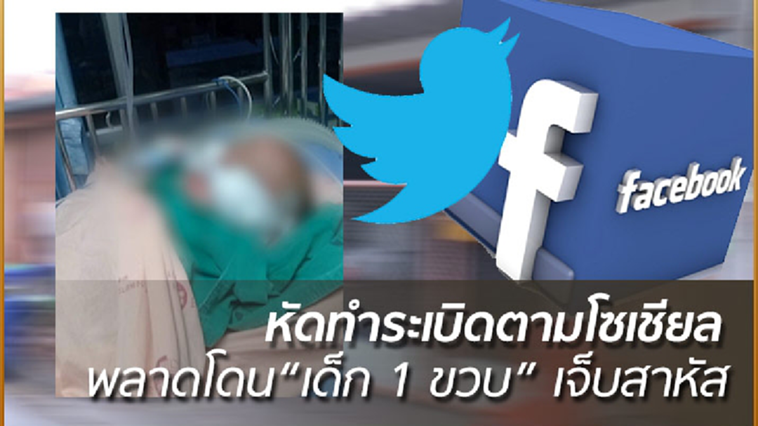 หัดทำระเบิดตามโซเชียล ไฟลุกพลาดโดน "เด็ก 1 ขวบ" เจ็บสาหัส หัดทำระเบิดตามโซเชียล ไฟลุกพลาดโดน "เด็ก 1 ขวบ" เจ็บสาหัส