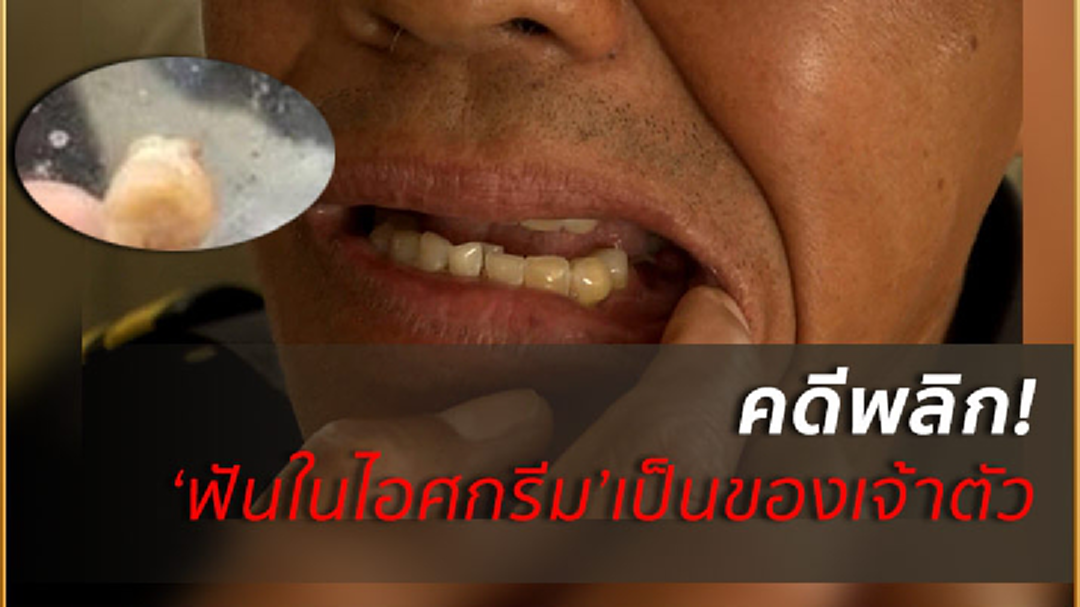 โอละพ่อ!เทศกิจโคราชพบฟันกรามในไอศกรีม ที่แท้เป็นของตัวเอง โอละพ่อ!เทศกิจโคราชพบฟันกรามในไอศกรีม ที่แท้เป็นของตัวเอง