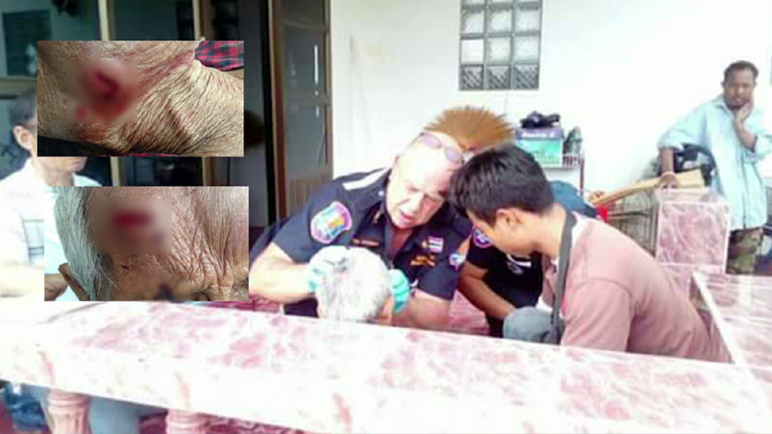 สุดระทึก!หมูป่าคลั่งขย้ำยายสาหัส ปศุสัตว์หวั่นติดพิษสุนัขบ้า สุดระทึก!หมูป่าคลั่งขย้ำยายสาหัส ปศุสัตว์หวั่นติดพิษสุนัขบ้า