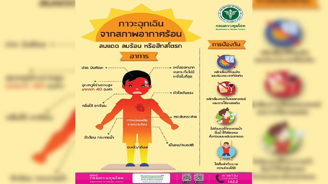 ร้อนจัดเสี่ยง"ฮีทสโตรก" สธ.เปิดสถิติผู้เสียชีวิตปีละ 32 คน ร้อนจัดเสี่ยง"ฮีทสโตรก" สธ.เปิดสถิติผู้เสียชีวิตปีละ 32 คน