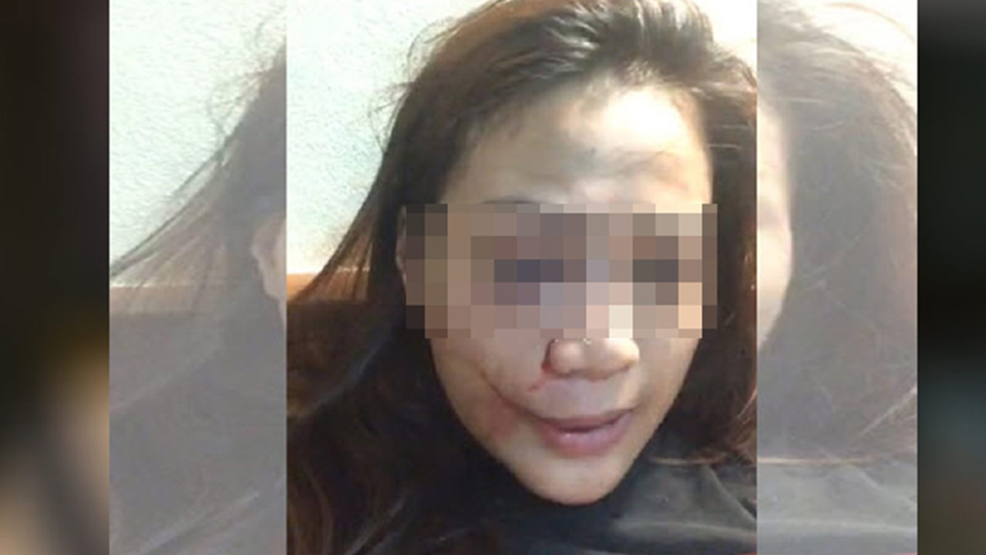 สุดทน! สาวไลฟ์สดนั่งน้ำตานองถูกแฟนหนุ่มสวนหน้าเหตุแค่บุหรี่ไฟฟ้า สุดทน! สาวไลฟ์สดนั่งน้ำตานองถูกแฟนหนุ่มสวนหน้าเหตุแค่บุหรี่ไฟฟ้า