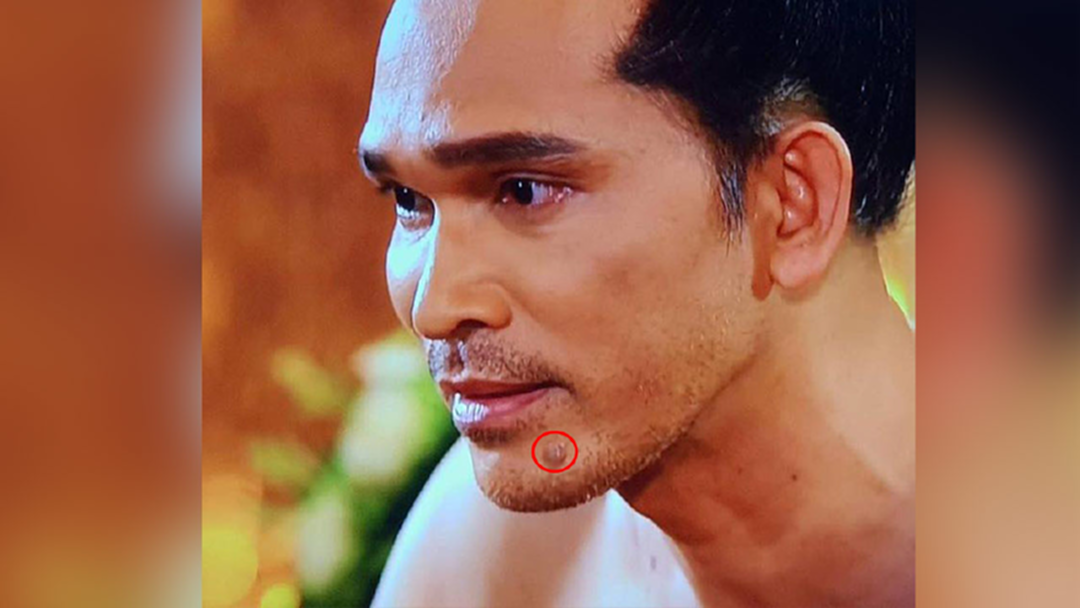 เก็บทุกเม็ด! "ไฝ" บนหน้า "ขุนหลวง" คือความตั้งใจของทีมงาน เก็บทุกเม็ด! "ไฝ" บนหน้า "ขุนหลวง" คือความตั้งใจของทีมงาน