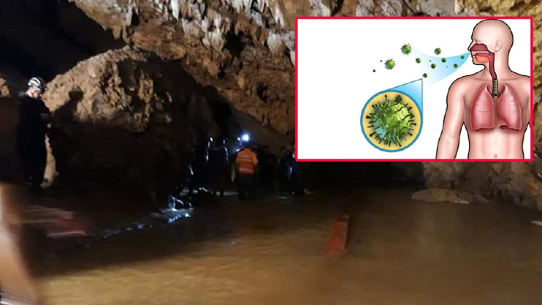 อะไร? คือ ตัวกระตุ้น! ให้อาการหืดหอบกำเริบ “เด็กติดถ้ำหลวง” อะไร? คือ ตัวกระตุ้น! ให้อาการหืดหอบกำเริบ “เด็กติดถ้ำหลวง”