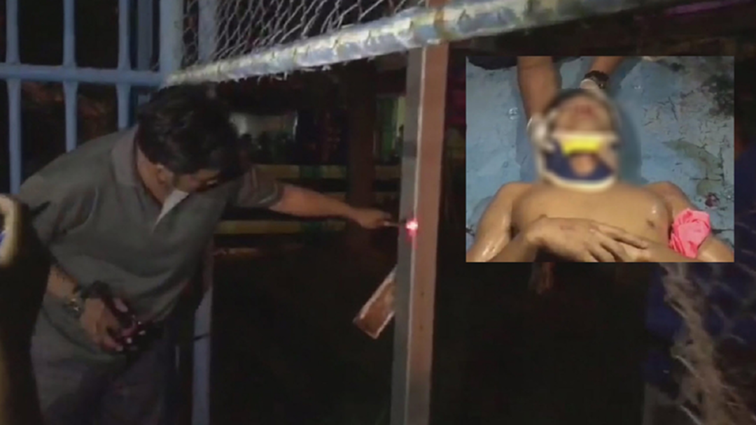 ไฟฟ้าสนามบอลเทศบาลรั่ว ช็อตหนุ่ม16สาหัส เลือดคั่งในสมอง