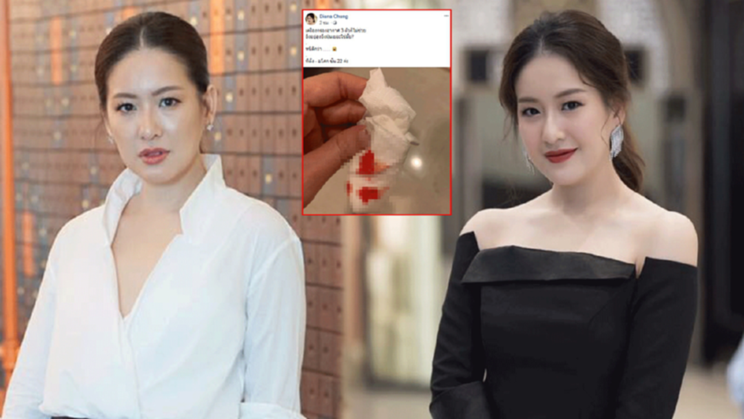 โดนเข้ากับตัว "ได๋ ไดอาน่า" โดนฝุ่นละออง PM 2.5 ทำพิษ โดนเข้ากับตัว "ได๋ ไดอาน่า" โดนฝุ่นละออง PM 2.5 ทำพิษ
