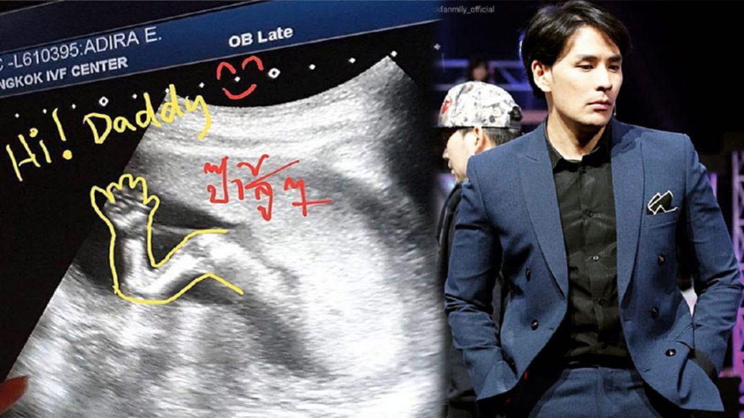 "แทค ภรัณยู" โพสต์ภาพอัลตราซาวด์ลูก ส่งกำลังใจ ป๊าสู้ๆ ผ่านมรสุมดราม่า "แทค ภรัณยู" โพสต์ภาพอัลตราซาวด์ลูก ส่งกำลังใจ ป๊าสู้ๆ ผ่านมรสุมดราม่า