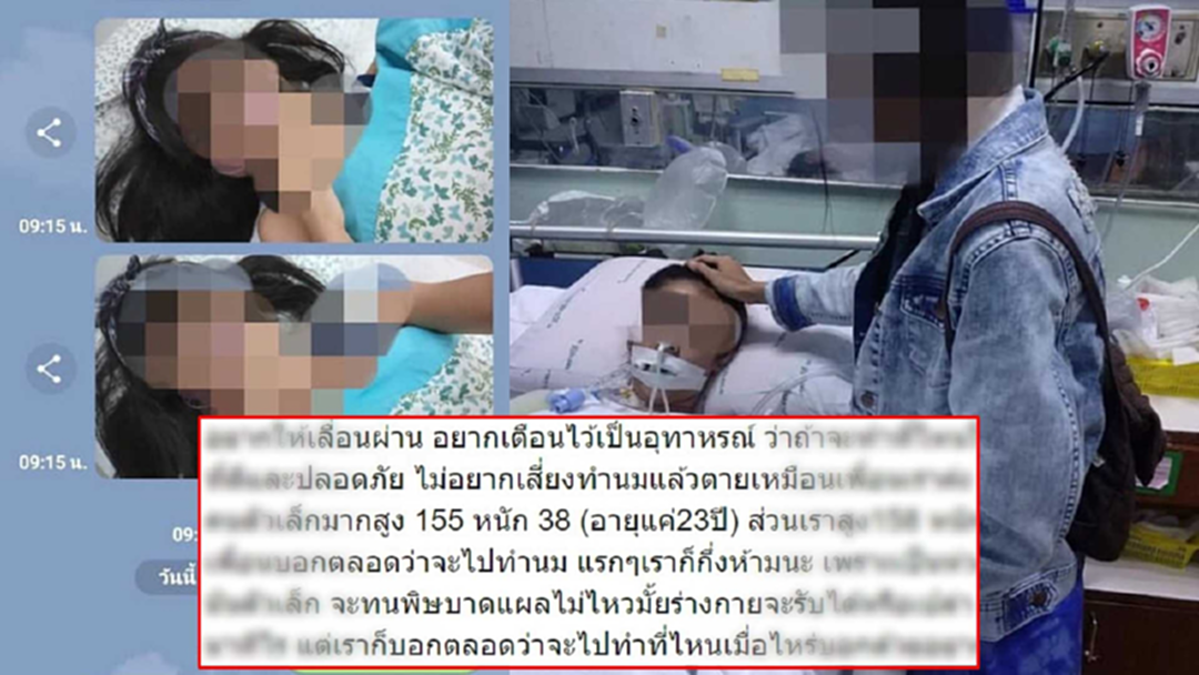 สาวเล่า เพื่อนสนิทตัวเล็ก ทำศัลยกรรมหน้าอกเสียชีวิต ฝากอย่าเห็นแก่ของถูก สาวเล่า เพื่อนสนิทตัวเล็ก ทำศัลยกรรมหน้าอกเสียชีวิต ฝากอย่าเห็นแก่ของถูก