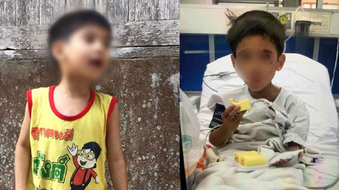 เจอตัวแล้ว!! "น้องกัปตัน" สภาพอิดโรย เปลือยเปล่าถูกทิ้งไว้ เร่งส่งรพ.ด่วน เจอตัวแล้ว!! "น้องกัปตัน" สภาพอิดโรย เปลือยเปล่าถูกทิ้งไว้ เร่งส่งรพ.ด่วน