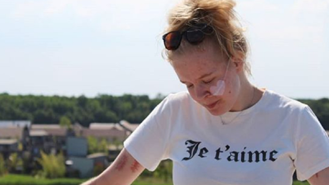 วัยรุ่นดัตช์รับการุณยฆาตหลังป่วยซึมเศร้าจากการถูกข่มขืนเมื่ออายุ 11 ปี วัยรุ่นดัตช์รับการุณยฆาตหลังป่วยซึมเศร้าจากการถูกข่มขืนเมื่ออายุ 11 ปี