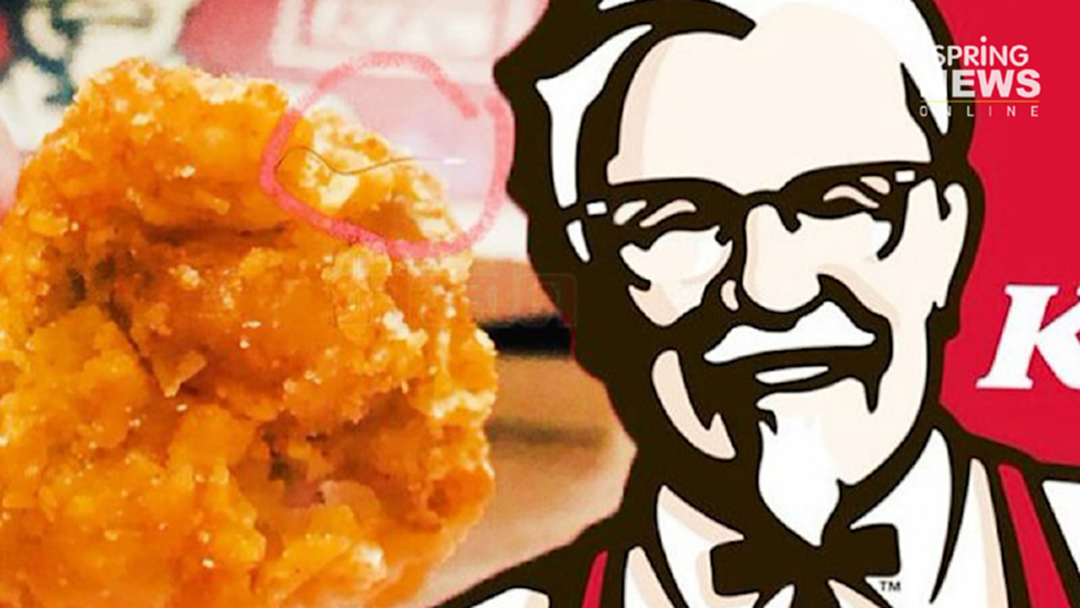 "เคเอฟซี" ส่งขนปริศนาพิสูจน์ ยอมจ่ายเงินคืนลูกค้าสาว "เคเอฟซี" ส่งขนปริศนาพิสูจน์ ยอมจ่ายเงินคืนลูกค้าสาว