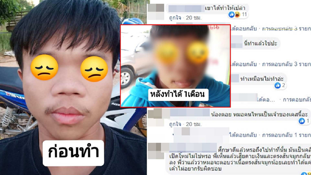 สาวร้องคลีนิคศัลฯ พาน้องชายไปทำจมูก ผลลัพธ์ออกมาแทบไม่ต่าง สาวร้องคลีนิคศัลฯ พาน้องชายไปทำจมูก ผลลัพธ์ออกมาแทบไม่ต่าง
