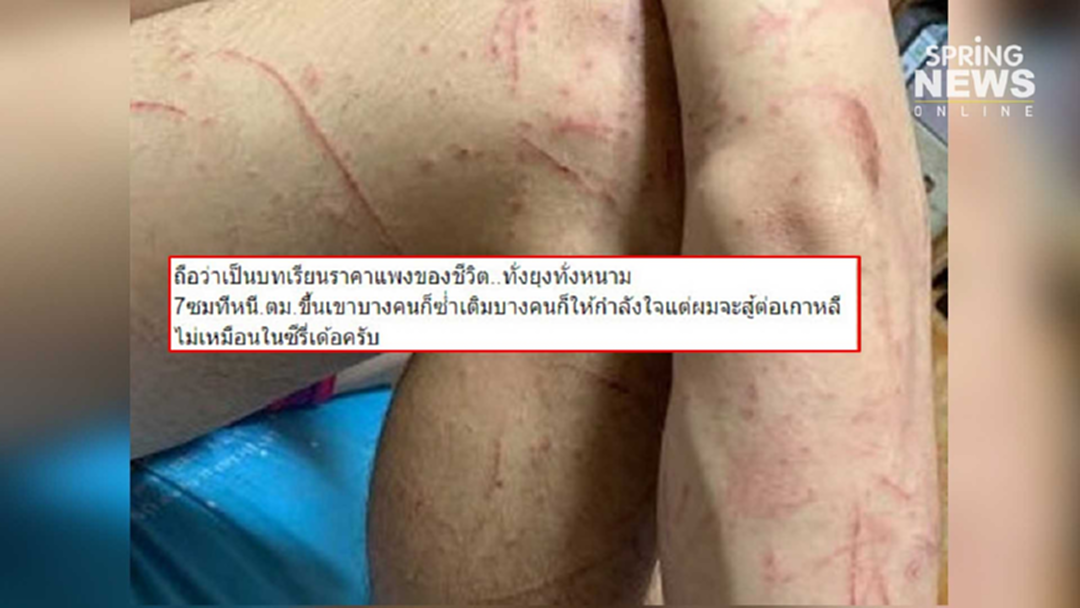 ผีน้อยระทม หลบตม.เกาหลีในดงไผ่ โอดคนซ้ำเติม ไม่ท้อขอสู้ต่อ ผีน้อยระทม หลบตม.เกาหลีในดงไผ่ โอดคนซ้ำเติม ไม่ท้อขอสู้ต่อ