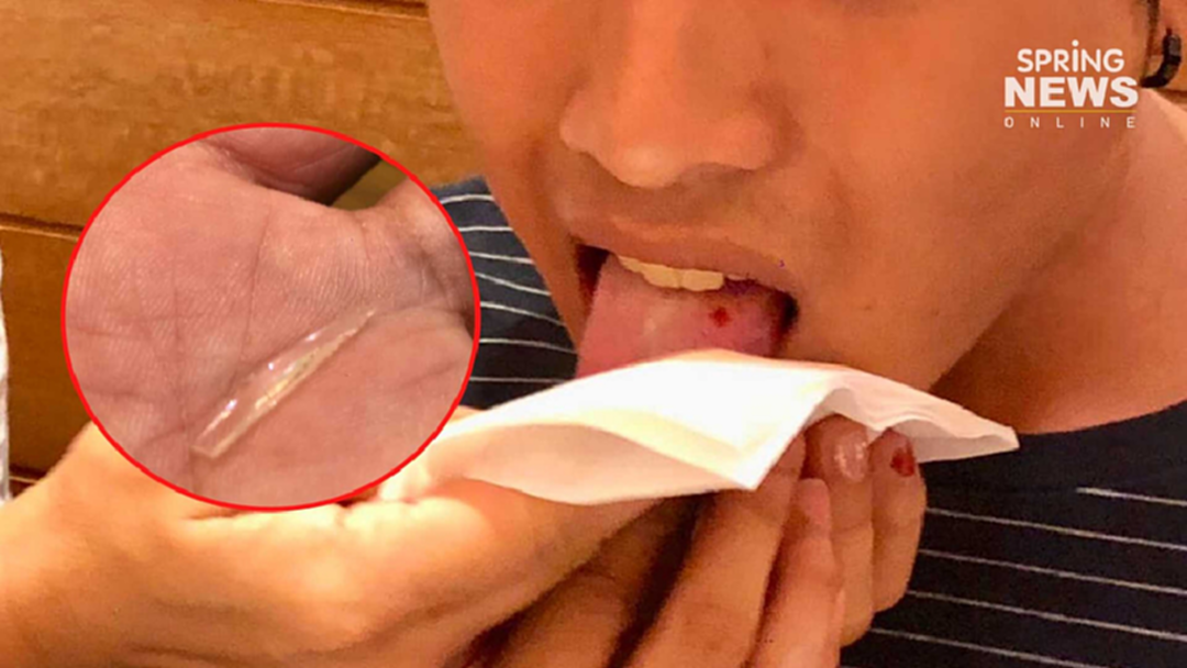 สยอง! พ่อร้อง "เศษแก้วคม" ปนในอาหารร้านดัง บาดลิ้นลูกชายเลือดไหล