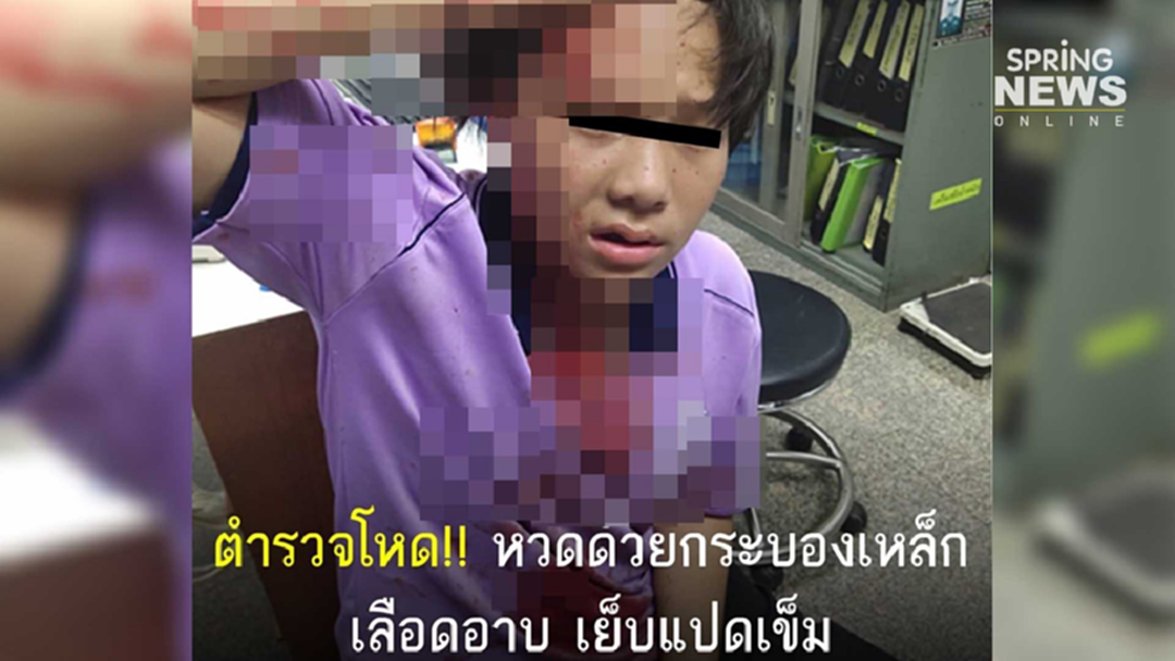ตำรวจดุ! ไม่สวมหมวกกันน็อค - ขับหนี ใช้กระบองเหล็กฟาดเด็กหญิง ม.3 หัวแตก ตำรวจดุ! ไม่สวมหมวกกันน็อค - ขับหนี ใช้กระบองเหล็กฟาดเด็กหญิง ม.3 หัวแตก