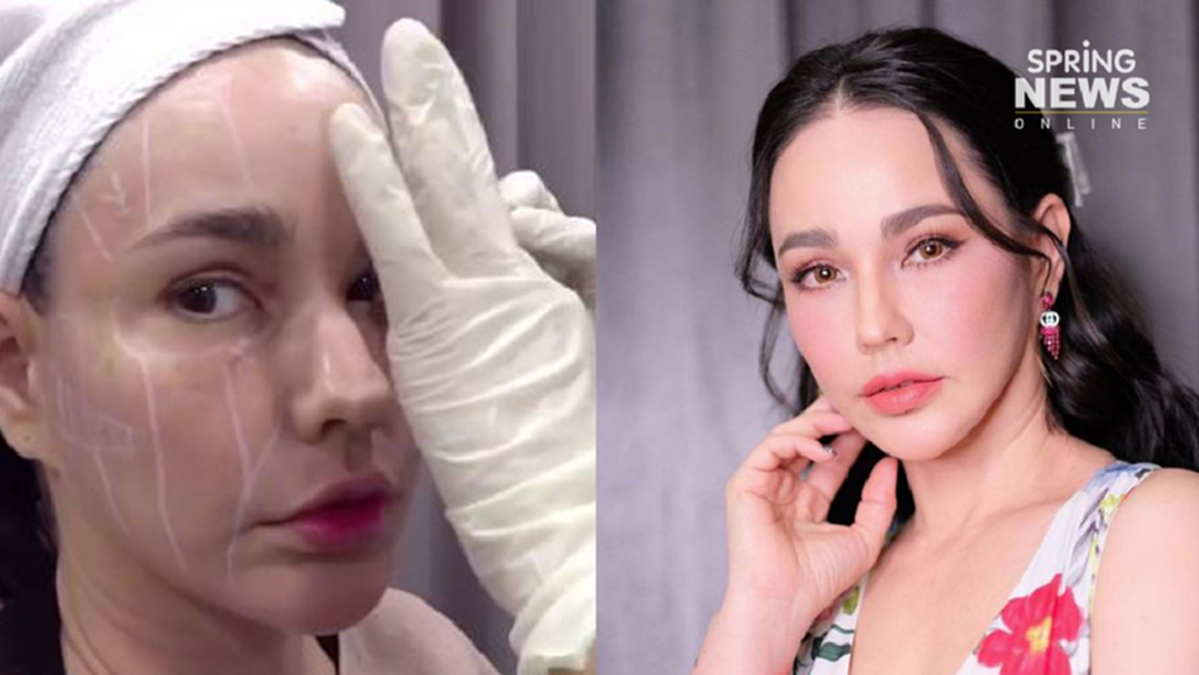 "แหม่ม วิชุดา" อัปหน้าใหม่อีกรอบไม่กี่วันสวยเด็กขึ้นทันตา "แหม่ม วิชุดา" อัปหน้าใหม่อีกรอบไม่กี่วันสวยเด็กขึ้นทันตา
