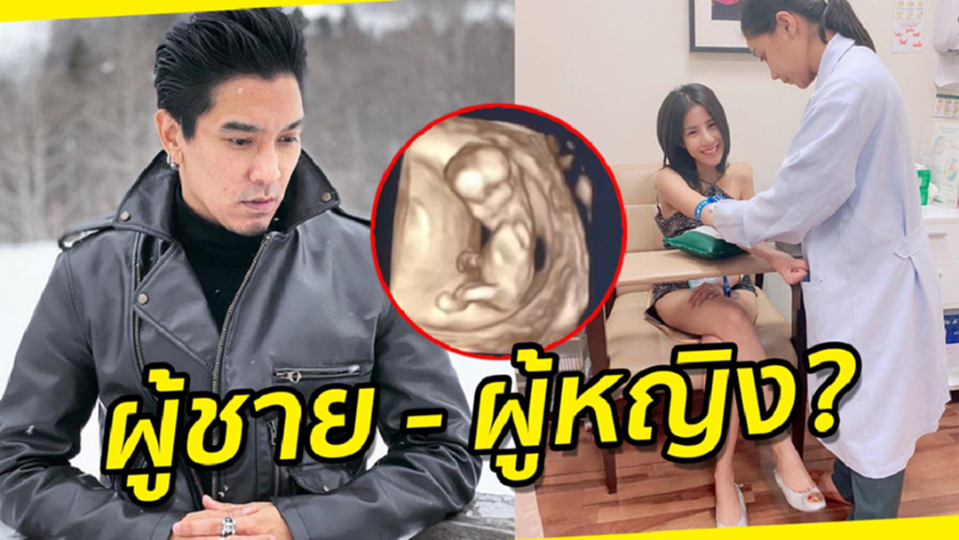 "ดีเจแมน" ชวนทายเพศลูก ซึ้งใจ "ใบเตย" ดูแลตัวเองอย่างดี "ดีเจแมน" ชวนทายเพศลูก ซึ้งใจ "ใบเตย" ดูแลตัวเองอย่างดี