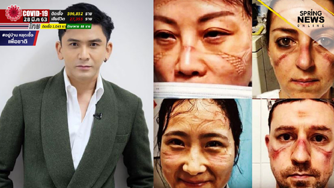 ป๋อ ณัฐวุฒิ เผย 10 ข้อคิด ต่อโรคโควิด 19 พร้อมขอบคุณทีมแพทย์ผู้เสียสละ