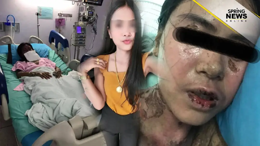 อุทาหรณ์! สาวปวดฟันคุด ซื้อยากินเอง สุดท้ายแพ้ยาหามเข้าห้อง ไอซียู อุทาหรณ์! สาวปวดฟันคุด ซื้อยากินเอง สุดท้ายแพ้ยาหามเข้าห้อง ไอซียู