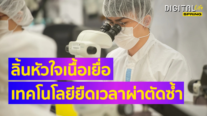 “ลิ้นหัวใจเนื้อเยื่อ“ เทคโนโลยีทางการแพทย์ ยืดเวลาผ่าตัดซ้ำ นานสุดถึง 30 ปี