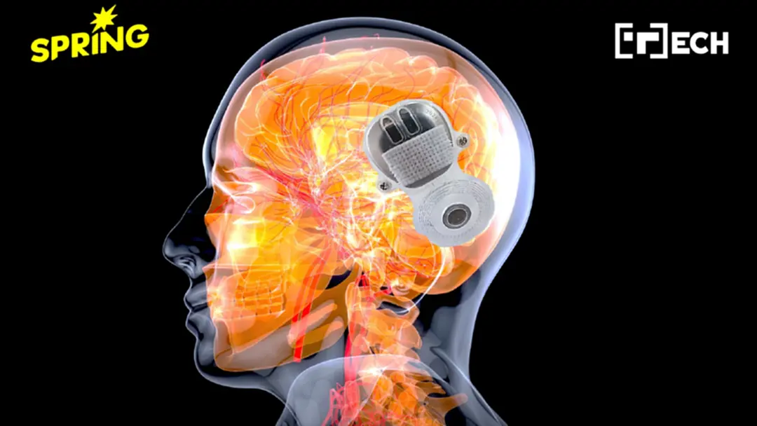 จีนอนุมัติ ‘อุปกรณ์ฝังสมอง’ เชื่อมคอมฯ สั่งการร่างกายได้ เครื่องแรกของโลก