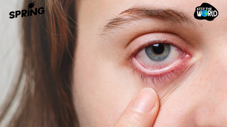 แพทย์ มช. เตือน PM2.5 ทำลายตา! แนะใส่แว่นแทนคอนแทคเลนส์