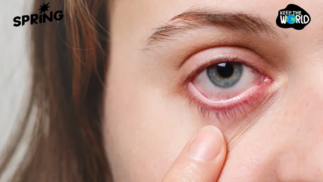 แพทย์ มช. เตือน PM2.5 ทำลายตา! แนะใส่แว่นแทนคอนแทคเลนส์ แพทย์ มช. เตือน PM2.5 ทำลายตา! แนะใส่แว่นแทนคอนแทคเลนส์