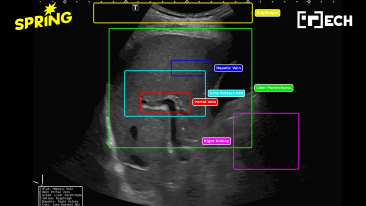 ‘AI ตรวจค่าตับ’ ฝีมือเด็กไทย รู้ผลใน 7 วินาที แม่นยำถึง 92%