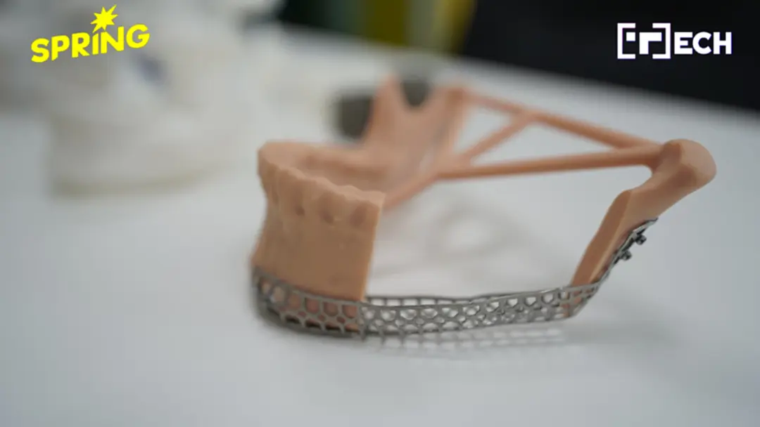 มจธ.ผนึก 3 รพ. ใช้ AI-3D Printing สร้างอุปกรณ์แพทย์เฉพาะบุคคล ลดความเสี่ยงการรักษา มจธ.ผนึก 3 รพ. ใช้ AI-3D Printing สร้างอุปกรณ์แพทย์เฉพาะบุคคล ลดความเสี่ยงการรักษา